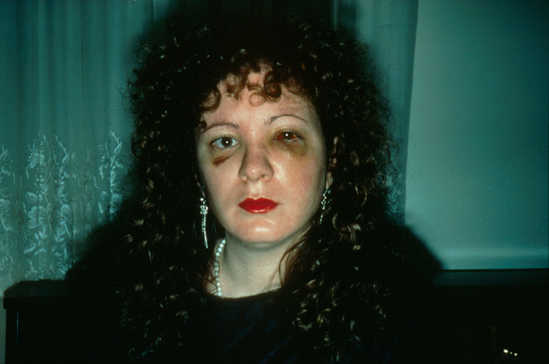 Nan Goldin, 'Nan One Month After Being Battered', 1984. From the series The Ballad of Sexual Dependency